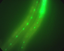 Bright-field image and fluorescence observation by fluorescence microscope