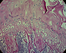 Cell staining