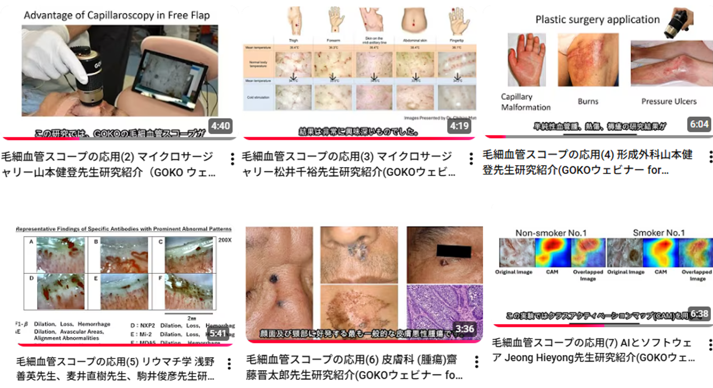 多くの医療研究と情報発信に支えられた毛細血管観察ノウハウ