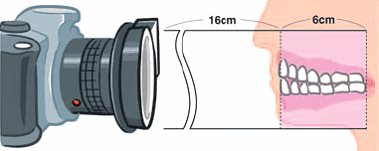 intraoral photography