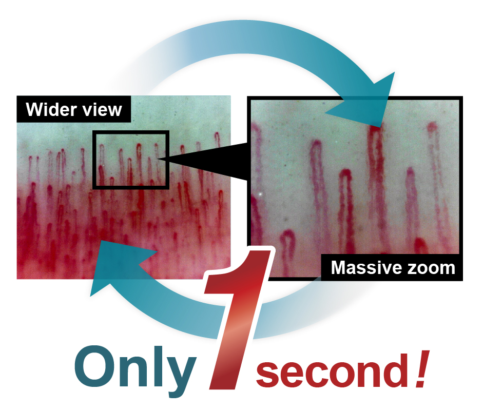 From Overview to Ultra-Zoom ― in Just One Second