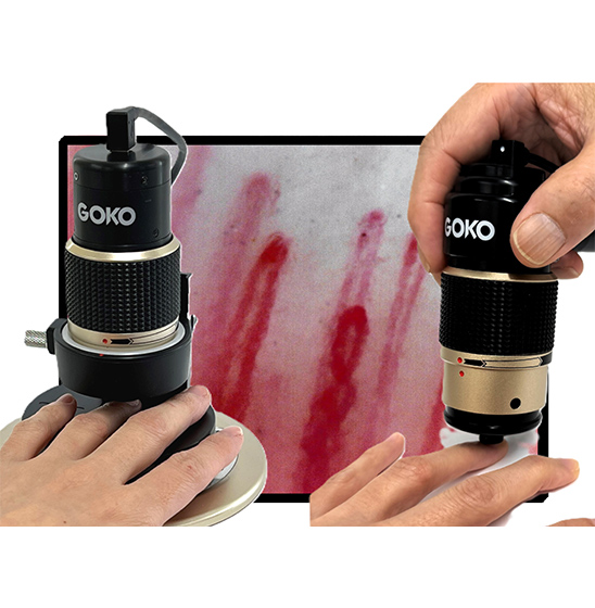 毛細血管スコープGOKO Bscan-ZR