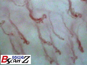 Upper gingiva(560x)