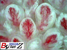 Tongue papillae capillaries (150×)