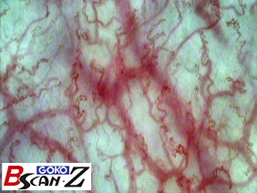 Labial Microvascular(150×)