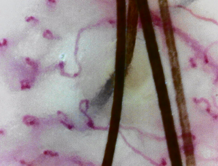 頭皮　毛細血管・血流（高倍率側）