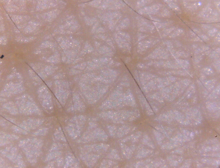 Skin surface (high magnification)thumbnail