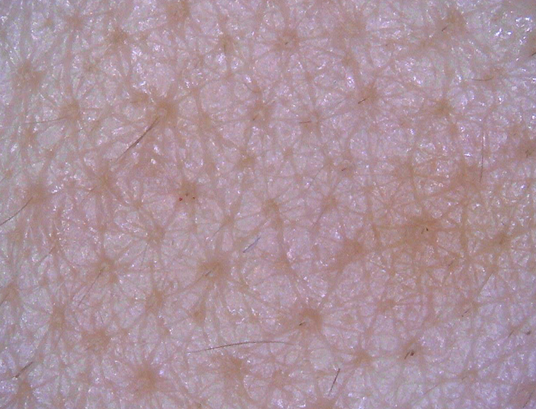 Skin surface（Medium magnification）
