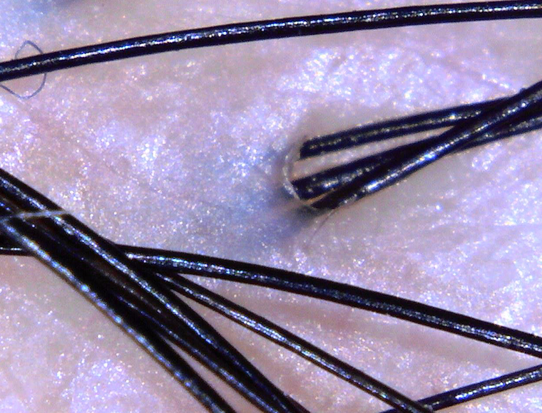 Hair and scalp thumbnail