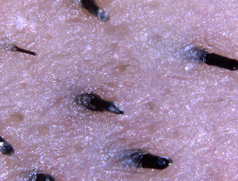 Pores and hair roots