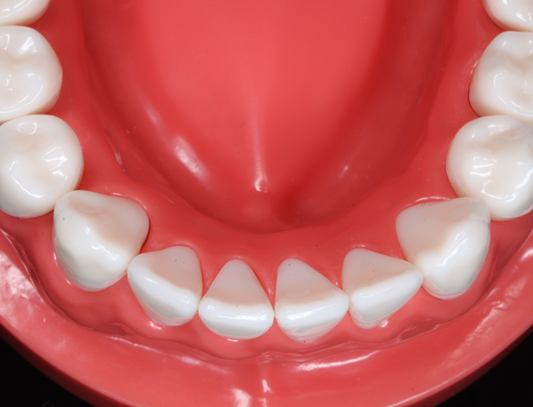 Mandibular occlusal view