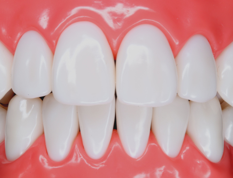 Frontal view (anterior teeth, close-up)