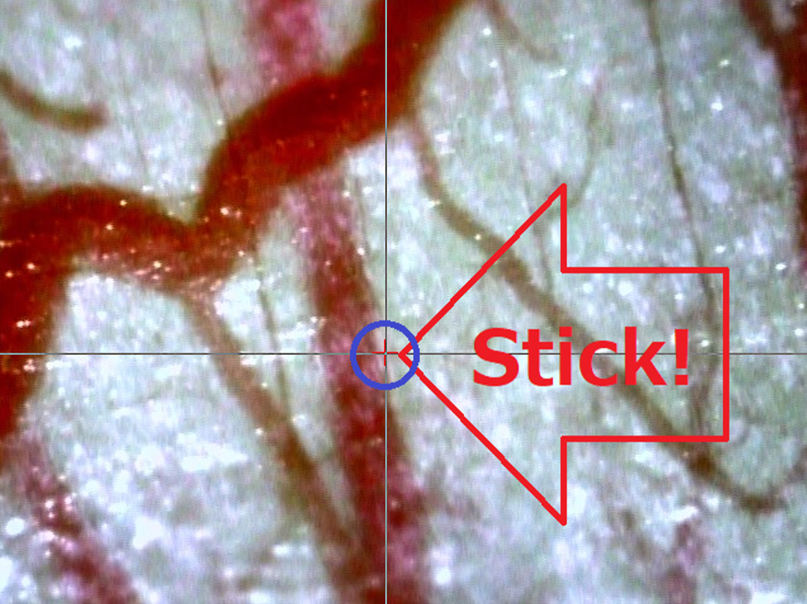 Example of Stick-to-edge Function