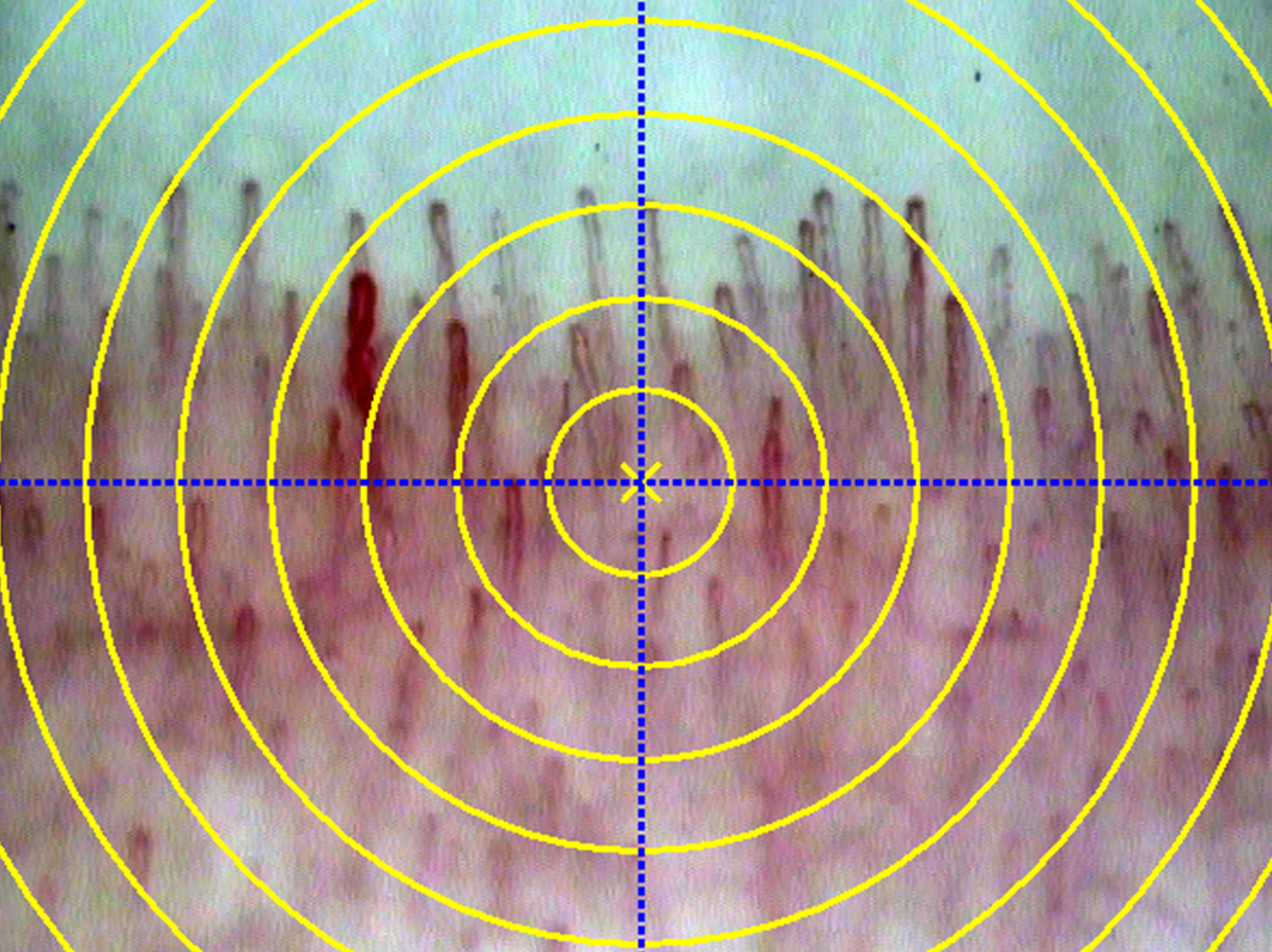 Crossline and Concentric Circles