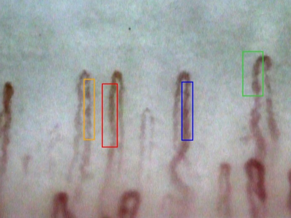 2. Rectangle Mode
