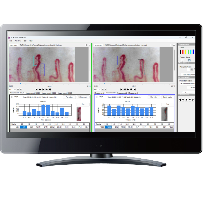 Software GOKO-VIP for blood flow velocity