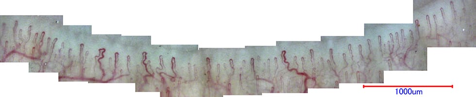Panoramic image of nailfold capillaries (590 x)