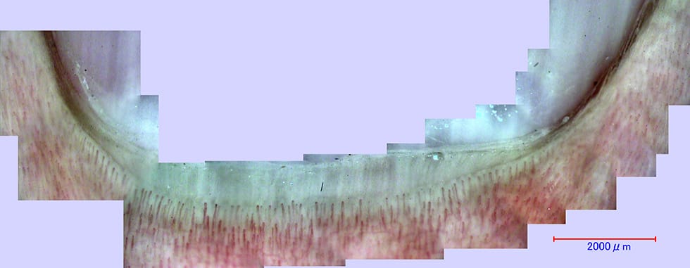 Panoramic image of nailfold capillaries (145 x)