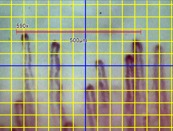 スケールバー表示、グリッド表示、画像中心線