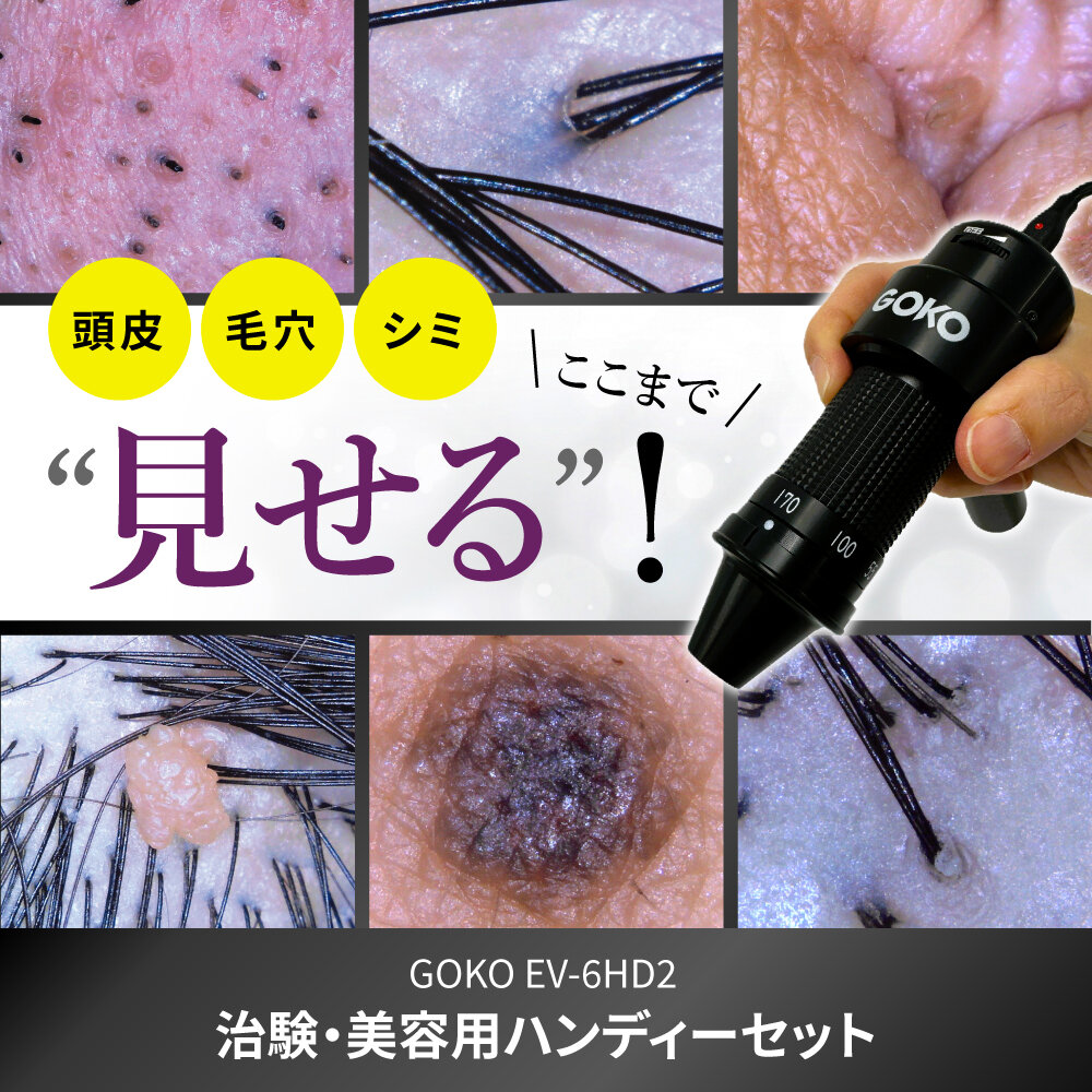EV-6HD2【治験・美容用ハンディーセット】なら、頭皮・毛穴・シミ、ここまで”見せる“！ 