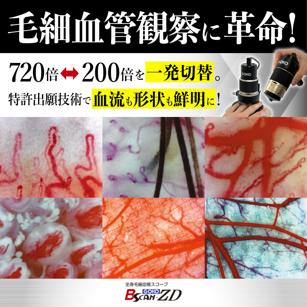 毛細血管観察に革命！ 720倍⇔200倍を一発切替。特許出願技術で血流も形状も鮮明に観察できる「Bscan-ZD」