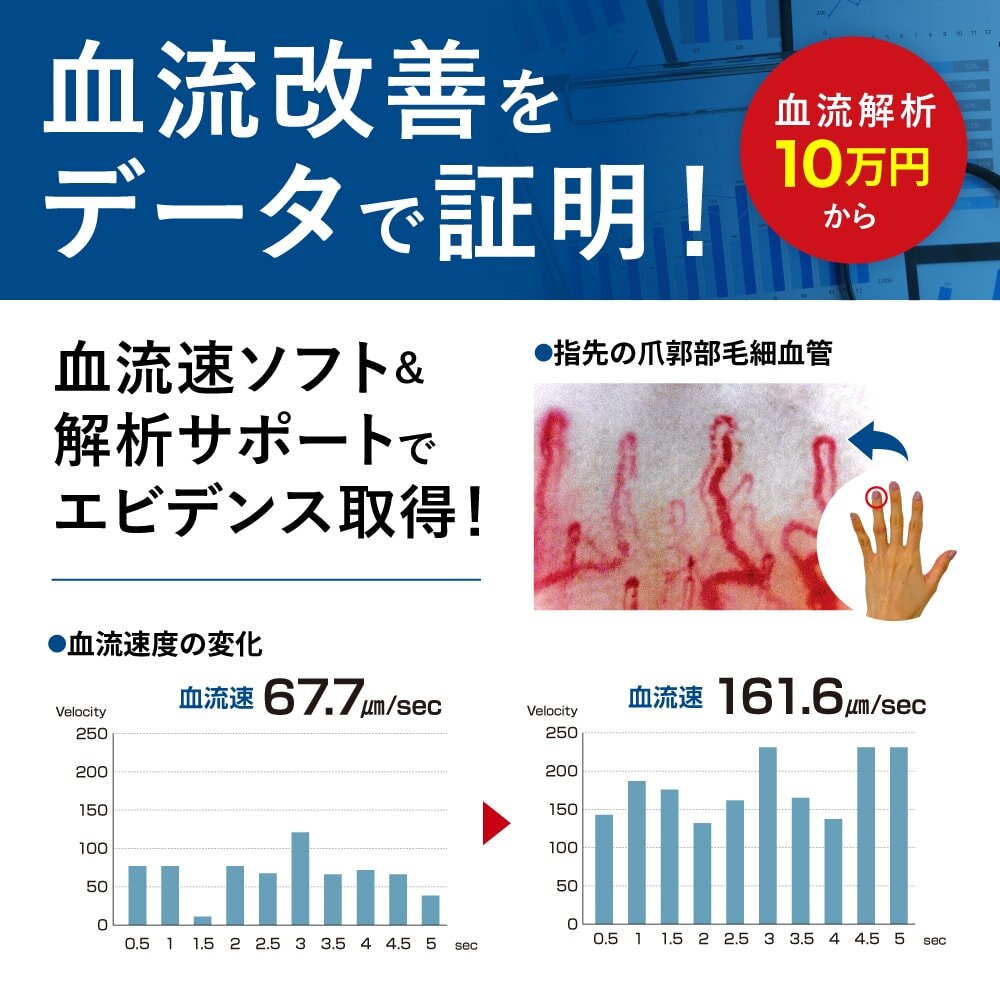 血流改善をデータで証明！血流速ソフト＆解析サポートでエビデンス取得！ 血流解析（画像解析）サービスは10万円〜