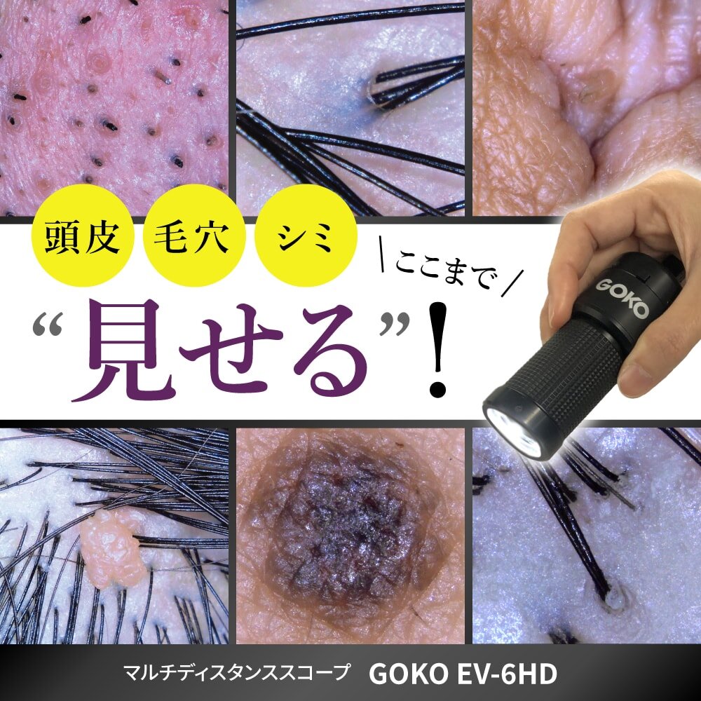 頭皮・毛穴・シミ、ここまで”見せる“！ EV-6HD