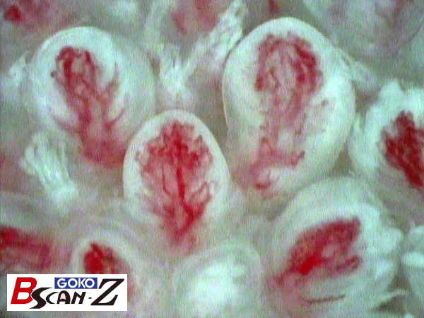 毛細血管血流スコープgoko Bscan Z Goko映像機器株式会社 製品サイト